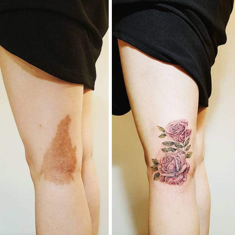 most creative birthmark tattoos